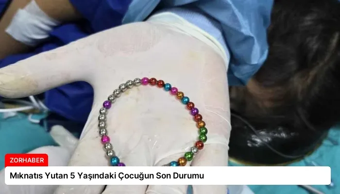 Mıknatıs Yutan 5 Yaşındaki Çocuğun Son Durumu