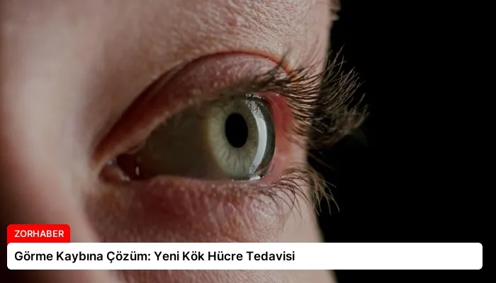 Görme Kaybına Çözüm: Yeni Kök Hücre Tedavisi